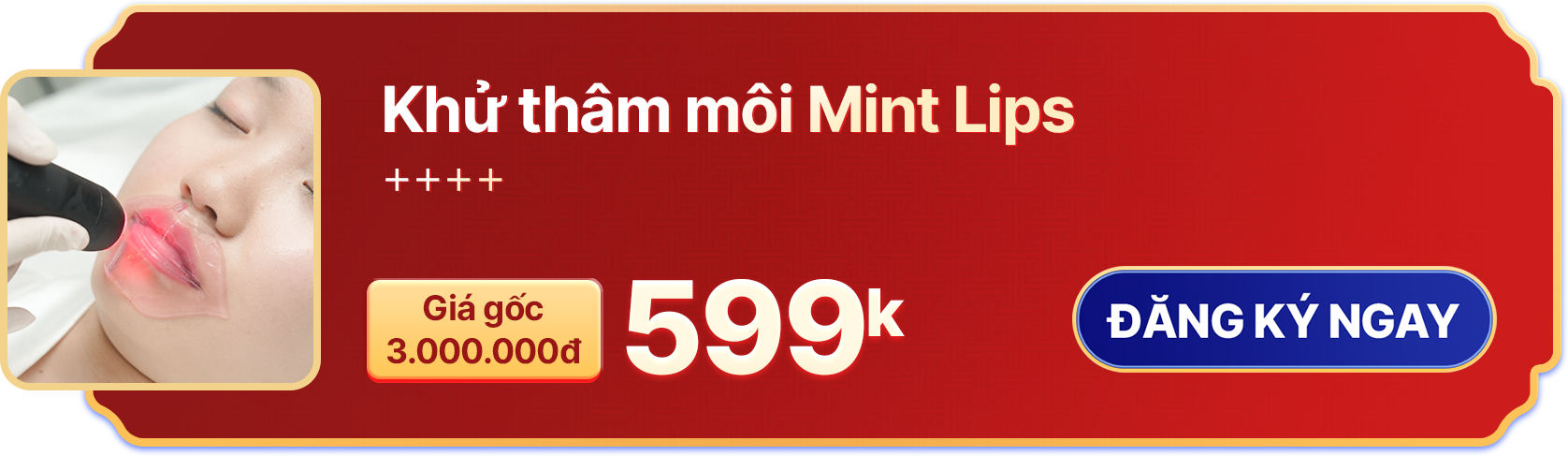 Khử thâm môi Mint Lips